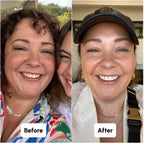 SHYNITE Strisce sbiancanti per denti