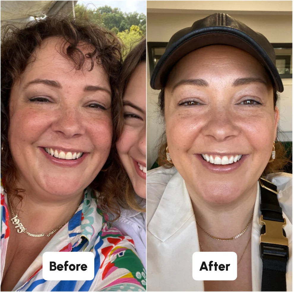 SHYNITE Strisce sbiancanti per denti