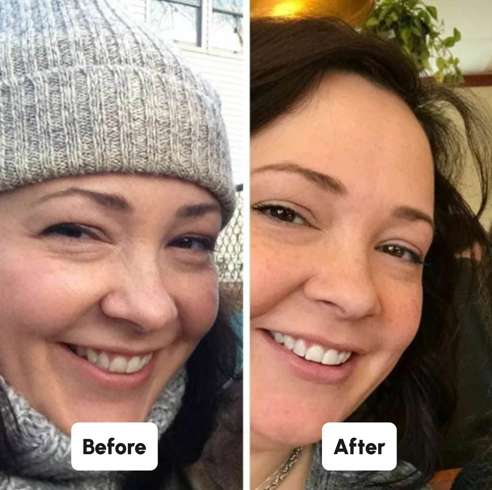 SHYNITE Strisce sbiancanti per denti