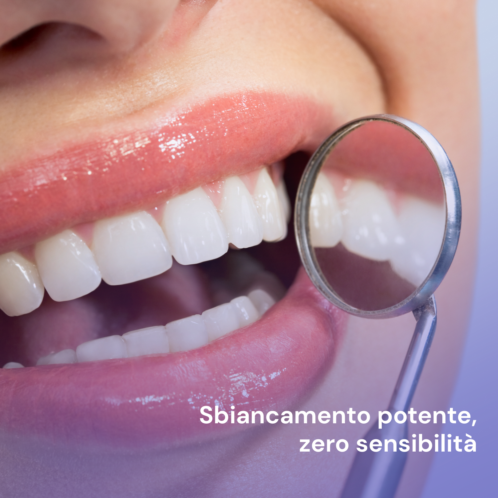 SHYNITE Strisce sbiancanti per denti